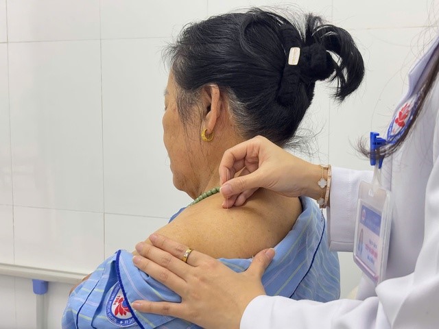 Tối ưu hóa hiệu quả điều trị thoát vị đĩa đệm đốt sống cổ bằng kết hợp Đông – Tây y- Ảnh 4.