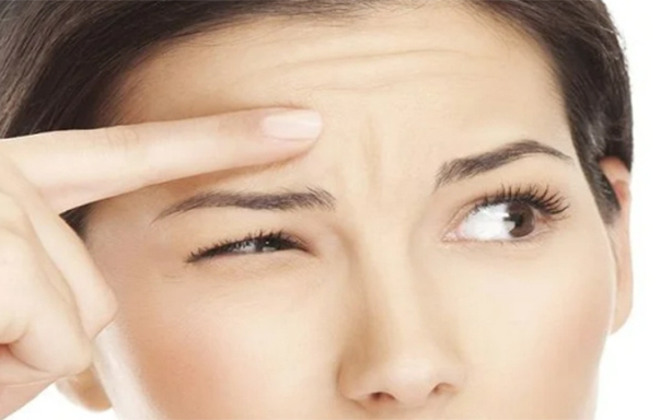 Nếp nhăn trán khi còn trẻ, làm sao để mờ dần?
