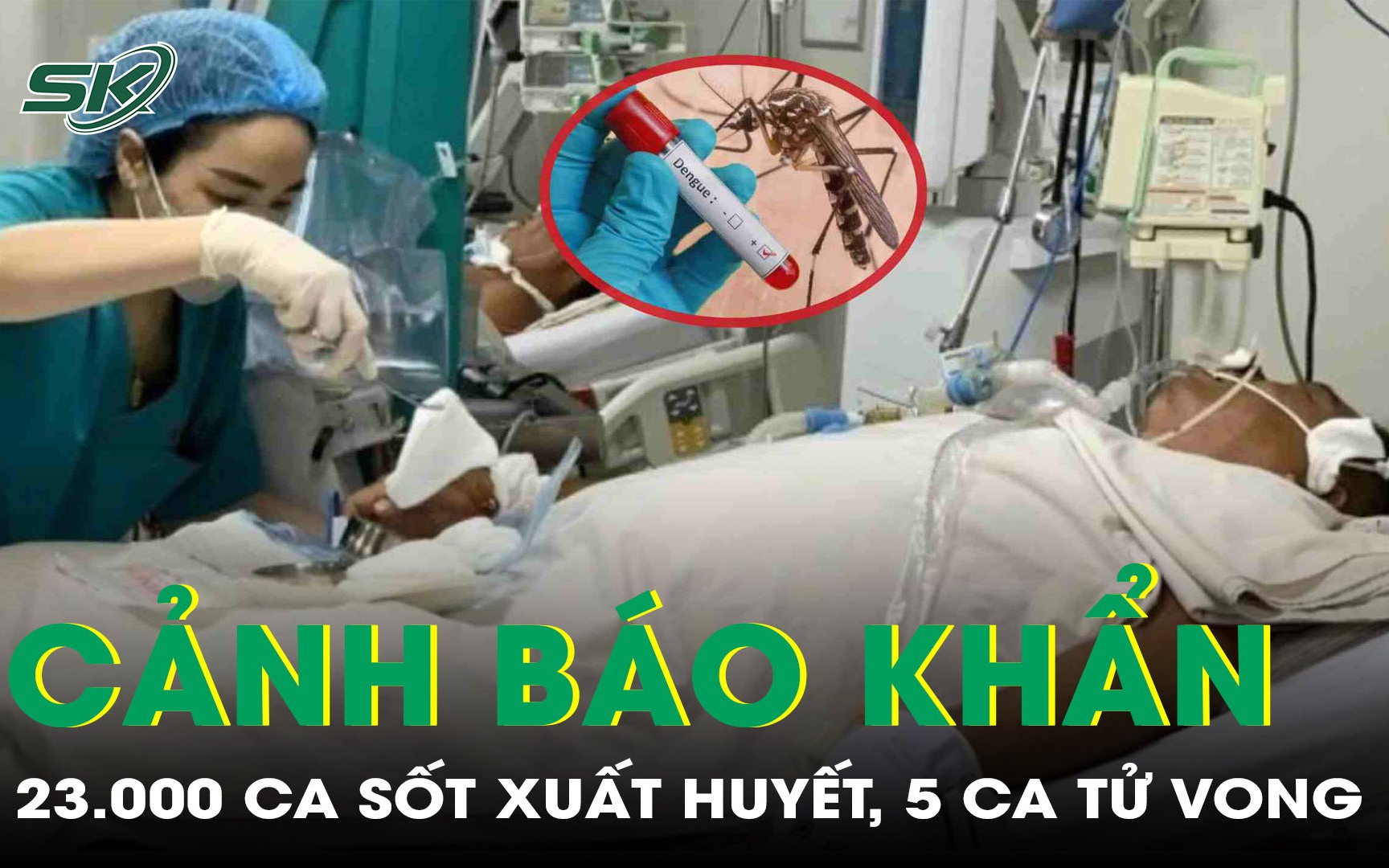 23.000 ca sốt xuất huyết, 5 ca tử vong, Bộ Y tế phát cảnh báo khẩn