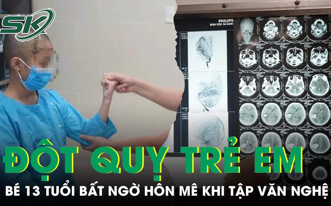 Bé 13 tuổi bất ngờ đột quỵ, hôn mê sâu khi đang tập văn nghệ ở trường