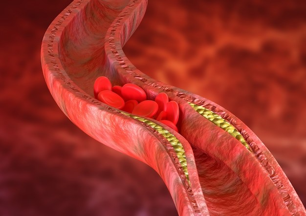 Cholesterol cao có thể gây ra rối loạn cương dương?- Ảnh 1. Cholesterol cao có thể gây ra rối loạn cương dương?- Ảnh 1.