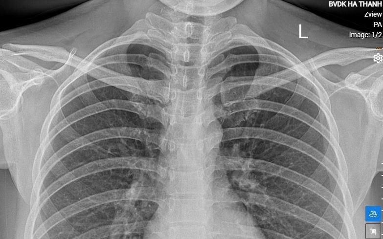 1 17508148123862055878070 0 0 489 783 crop 1750815214047165663360