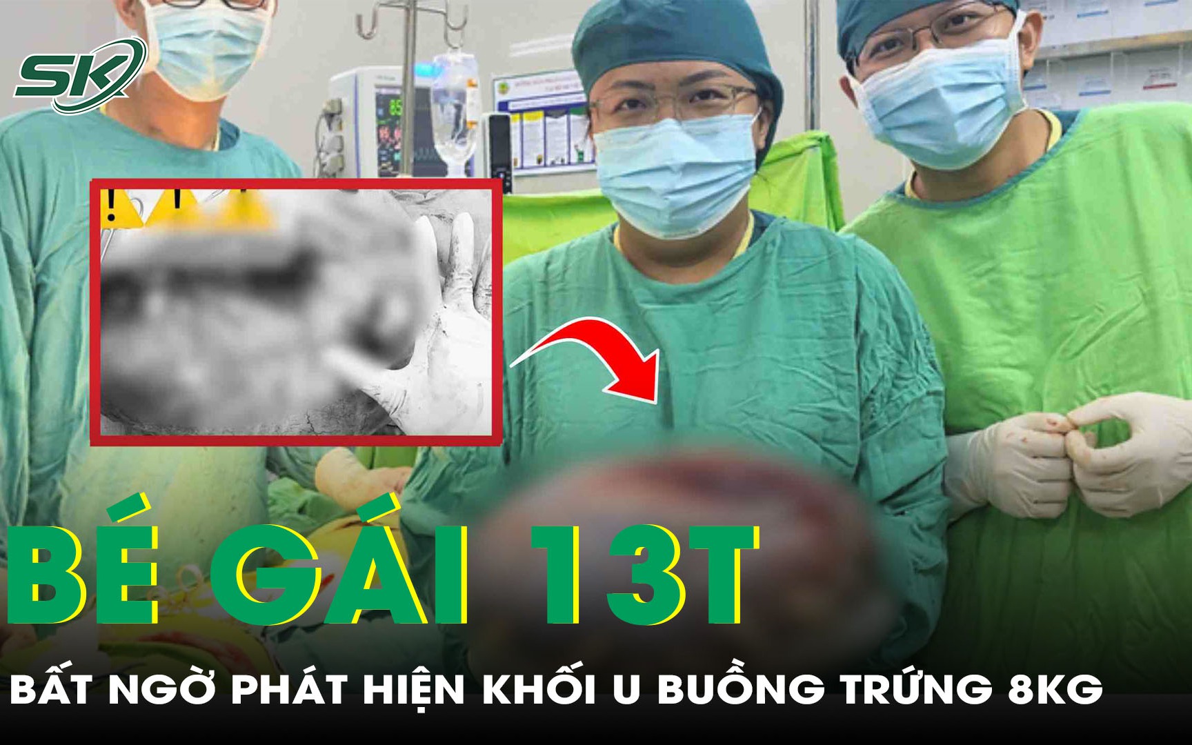 Khó tin: Bé gái 13 tuổi mang khối u buồng trứng gần 8kg mà không hay biết  