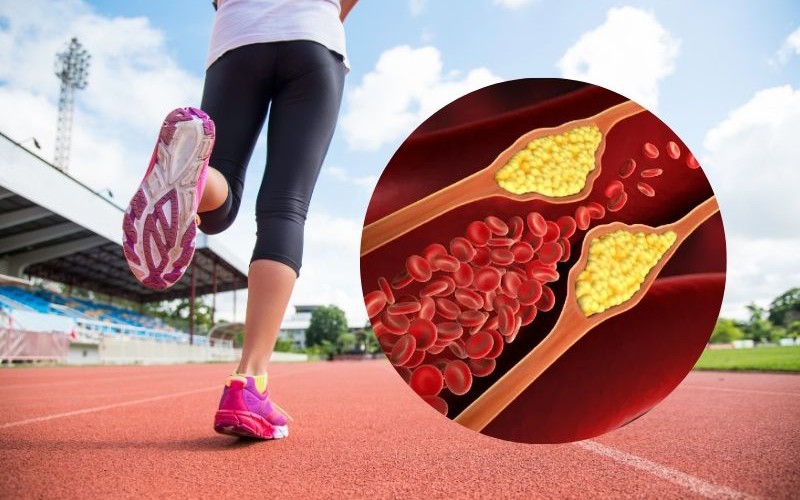 5 bài tập tốt nhất để giảm mỡ máu (cholesterol xấu) một cách tự nhiên- Ảnh 2. 5 bài tập tốt nhất để giảm mỡ máu (cholesterol xấu) một cách tự nhiên- Ảnh 2.