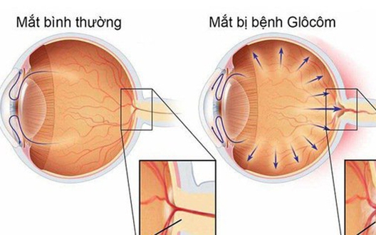 glocom goc mo 1 1735477722553756207268 0 17 330 545 crop 17510932501351507369177
