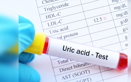 Người tăng axit uric cần tránh loại thực phẩm nào?