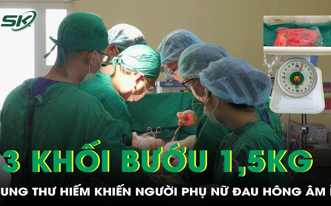 Phát hiện mắc 3 khối bướu sarcoma mỡ nặng 1,5 kg khiến người phụ nữ luôn mệt mỏi