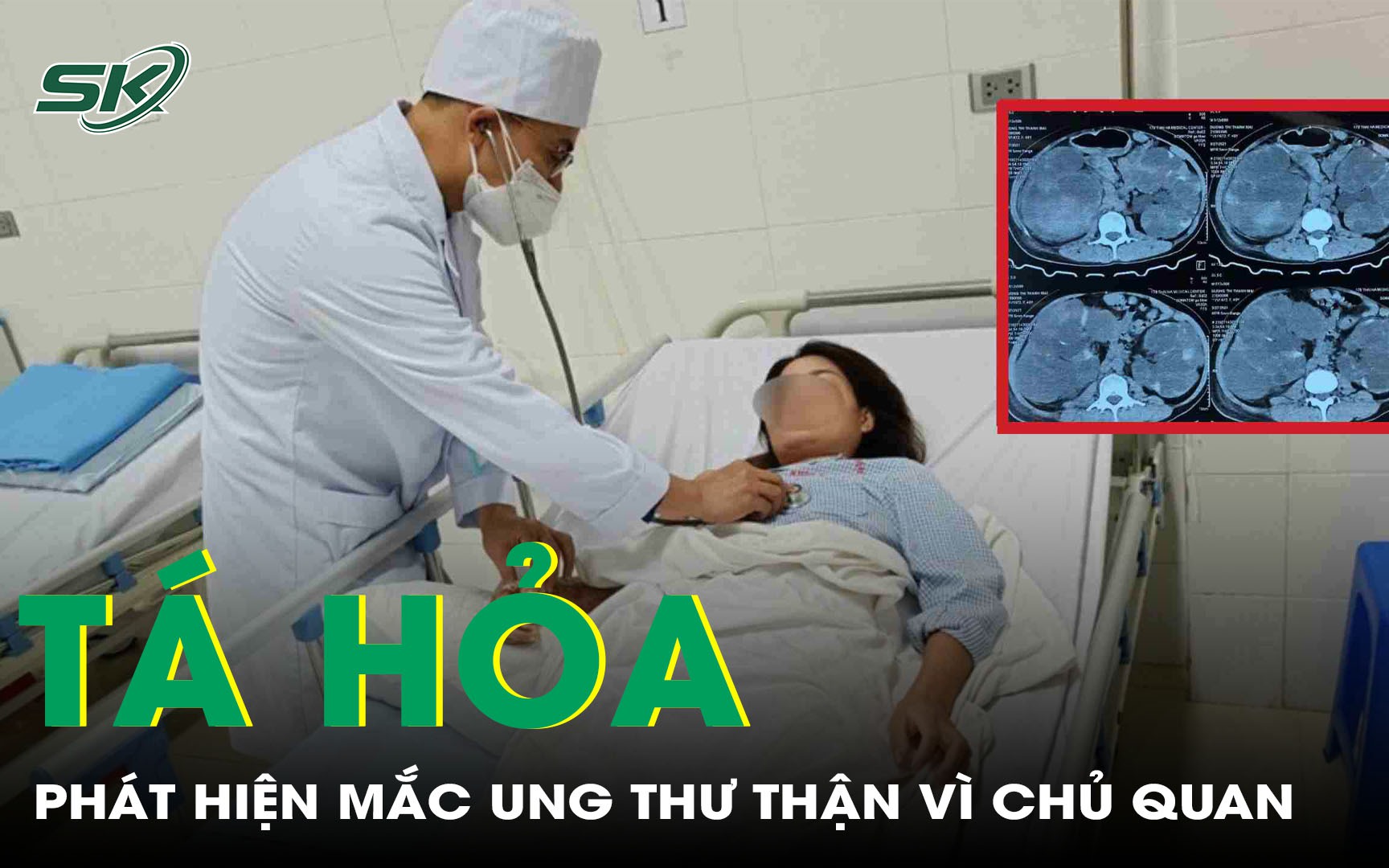Chủ quan nang thận lành tính, người phụ nữ tá hỏa phát hiện ung thư thận 