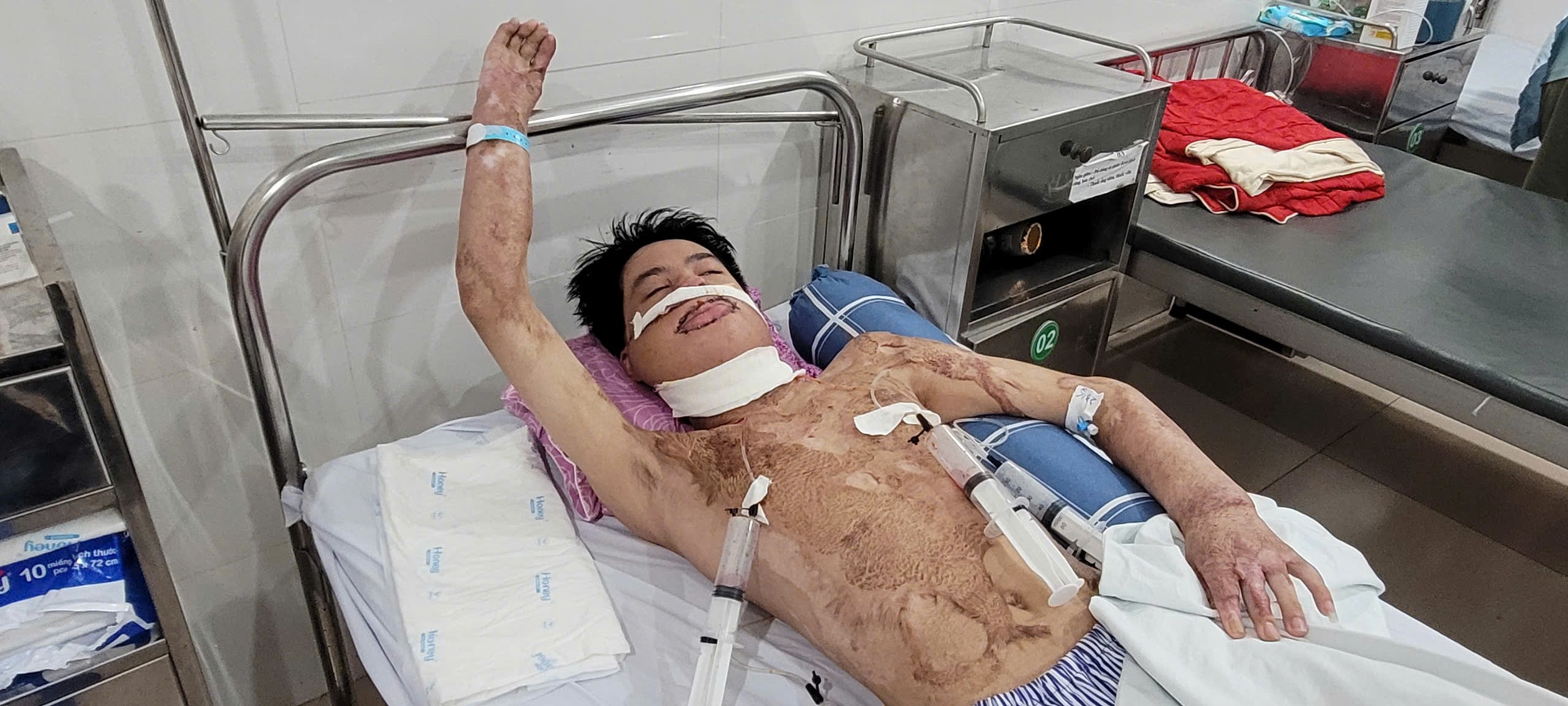 Mong một phép màu cho nam sinh bị bỏng điện cao thế 55% cơ thể- Ảnh 1. Mong một phép màu cho nam sinh bị bỏng điện cao thế 55% cơ thể- Ảnh 1.