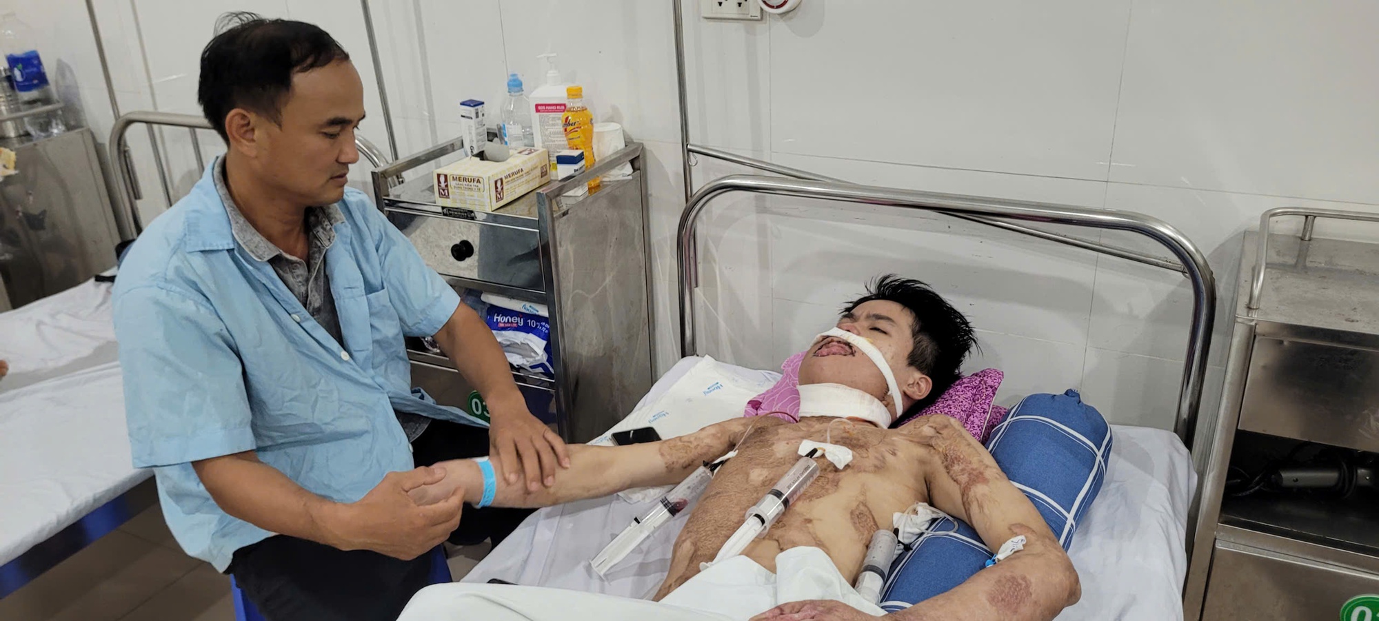 Mong một phép màu cho nam sinh bị bỏng điện cao thế 55% cơ thể- Ảnh 3. Mong một phép màu cho nam sinh bị bỏng điện cao thế 55% cơ thể- Ảnh 3.