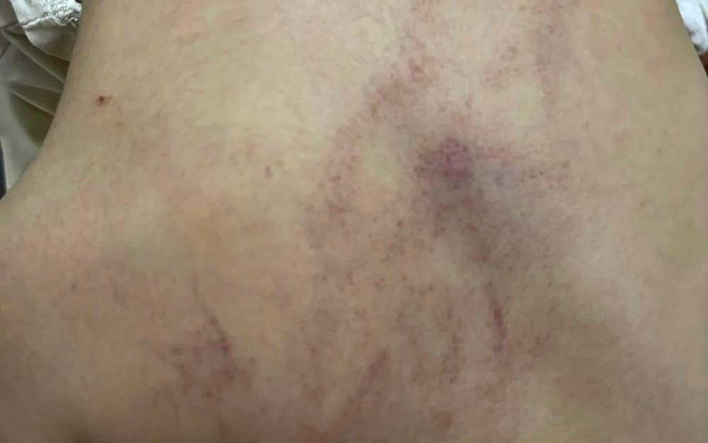 Vụ bạo hành trẻ ở Trường Mầm non Gia Thụy: 2 giáo viên bị tạm đình chỉ