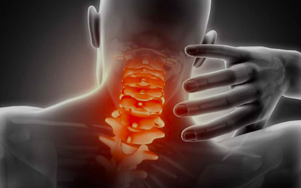 Đau cổ vai gáy có thể bị liệt nếu điều trị sai cách