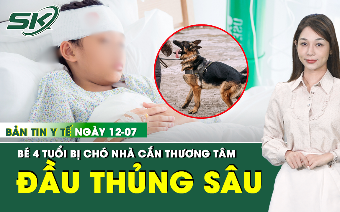 Bản Tin Y Tế 12/7: Thương tâm: Bị chó nhà cắn, bé 4 tuổi đầu thủng sâu