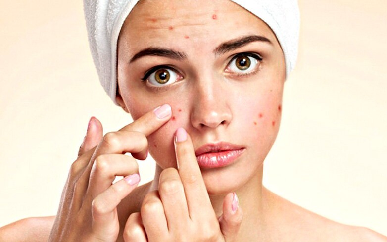 Cách xử lý mụn trứng cá, phục hồi làn da khỏe mạnh sau mụn