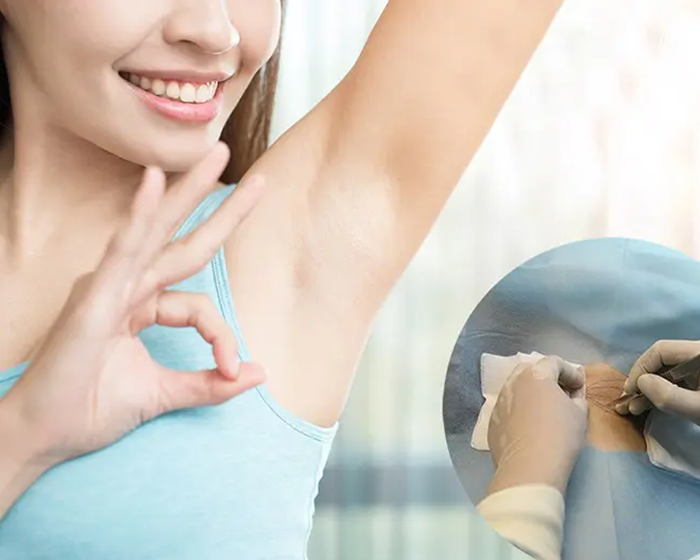 4 cách khử mùi hôi nách hiệu quả- Ảnh 2. 4 cách khử mùi hôi nách hiệu quả- Ảnh 2.