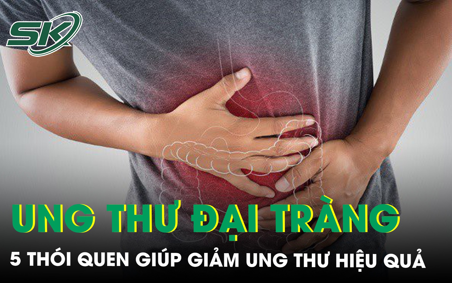 Thay đổi lối sống với 5 thói quen giúp giảm nguy cơ ung thư đại tràng