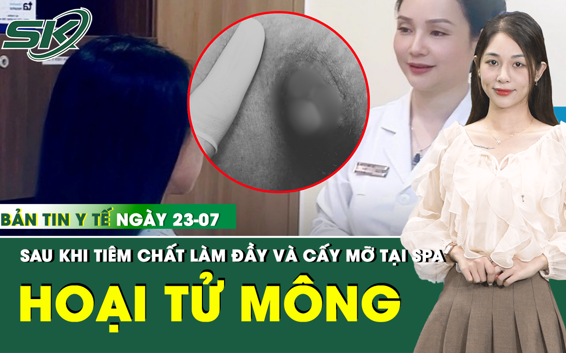 Sau tiêm nâng ngực 5 năm, nữ bệnh nhân bị biến chứng nặng- Ảnh 3.
