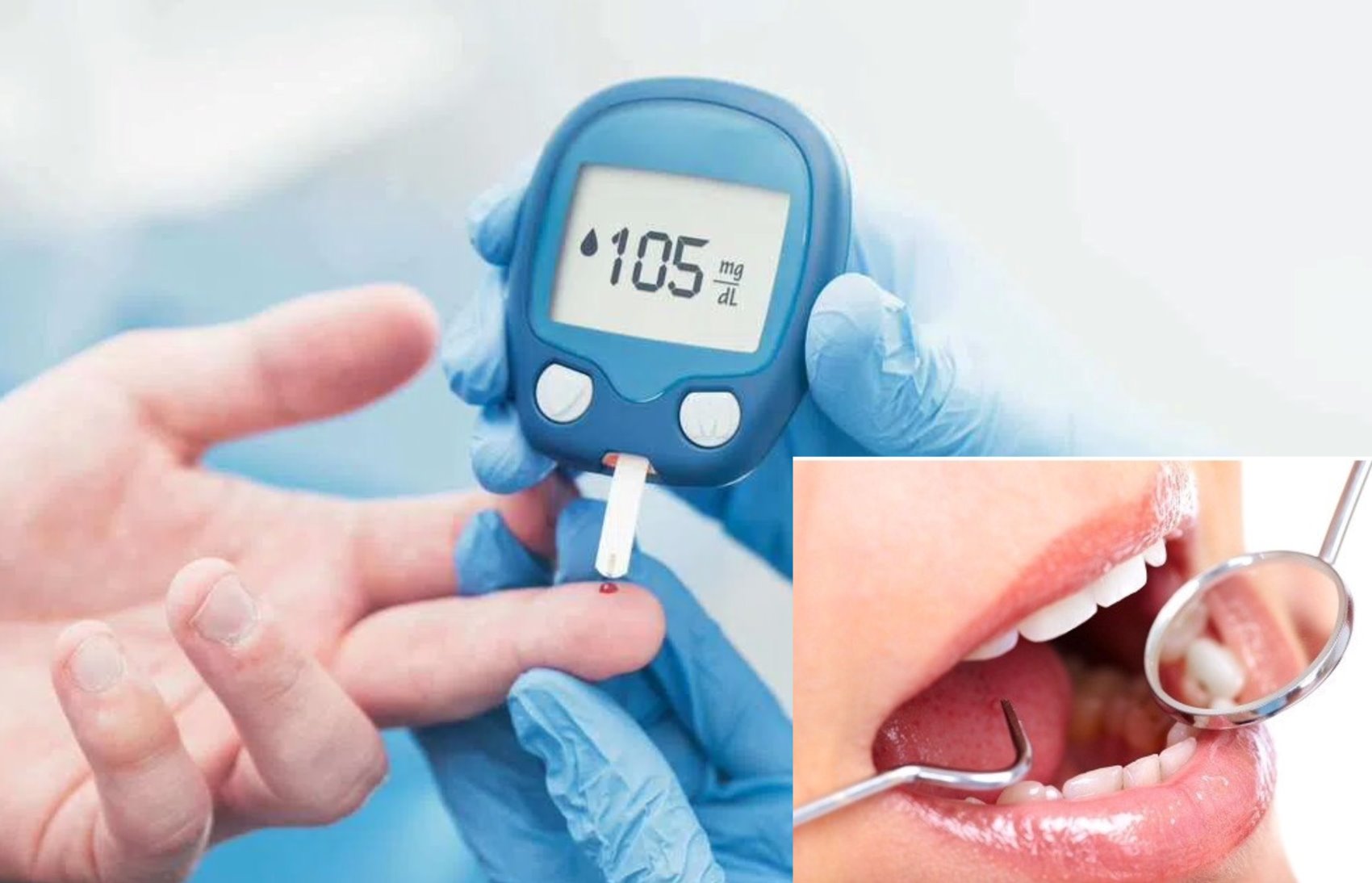 Bí quyết ngăn ngừa biến chứng răng miệng ở người bệnh tiểu đường- Ảnh 1.