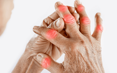 7 loại củ quả có lợi cho người bệnh viêm khớp dạng thấp