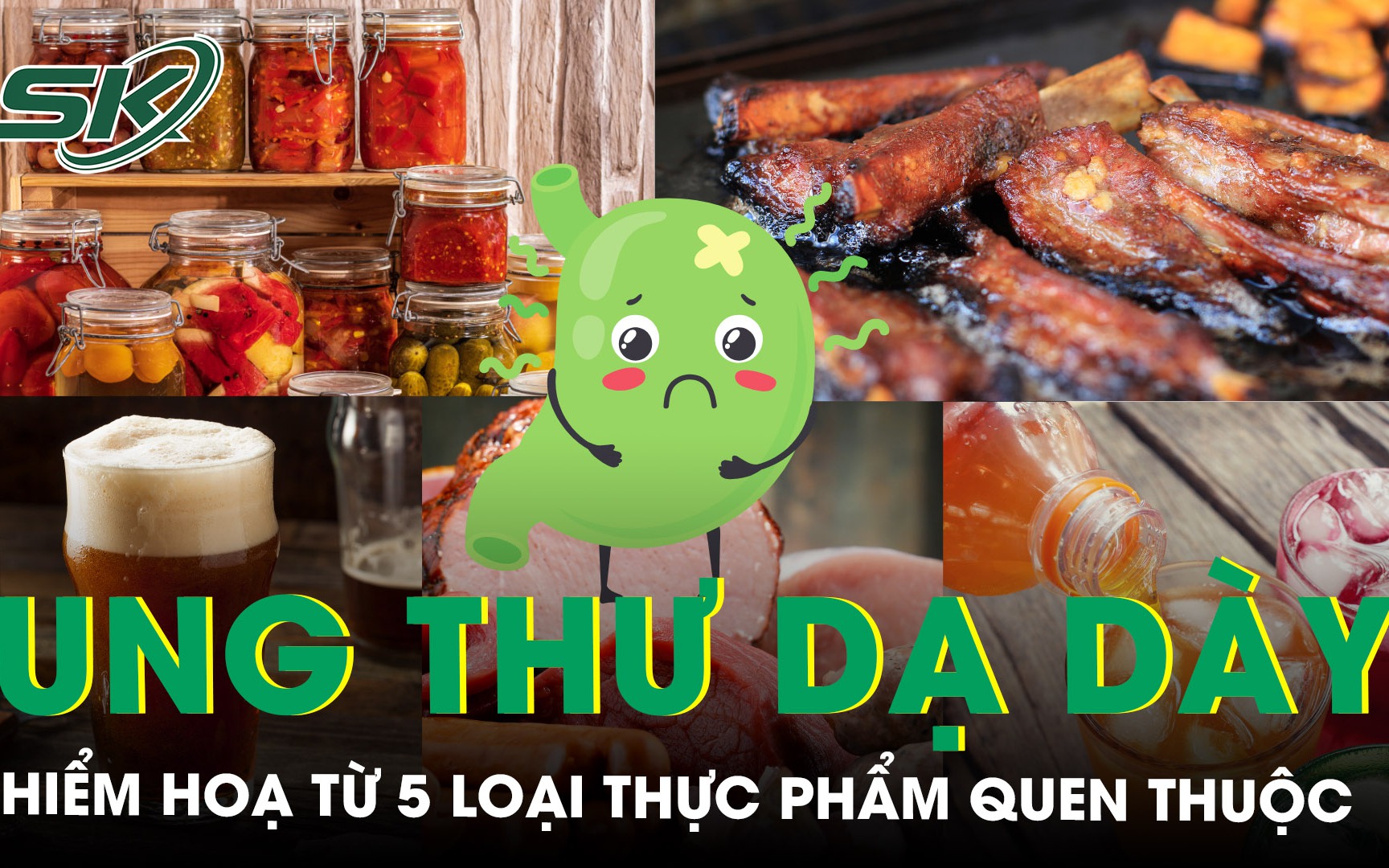 Hiểm họa ung thư dạ dày từ 5 loại thực phẩm quen thuộc hàng ngày 