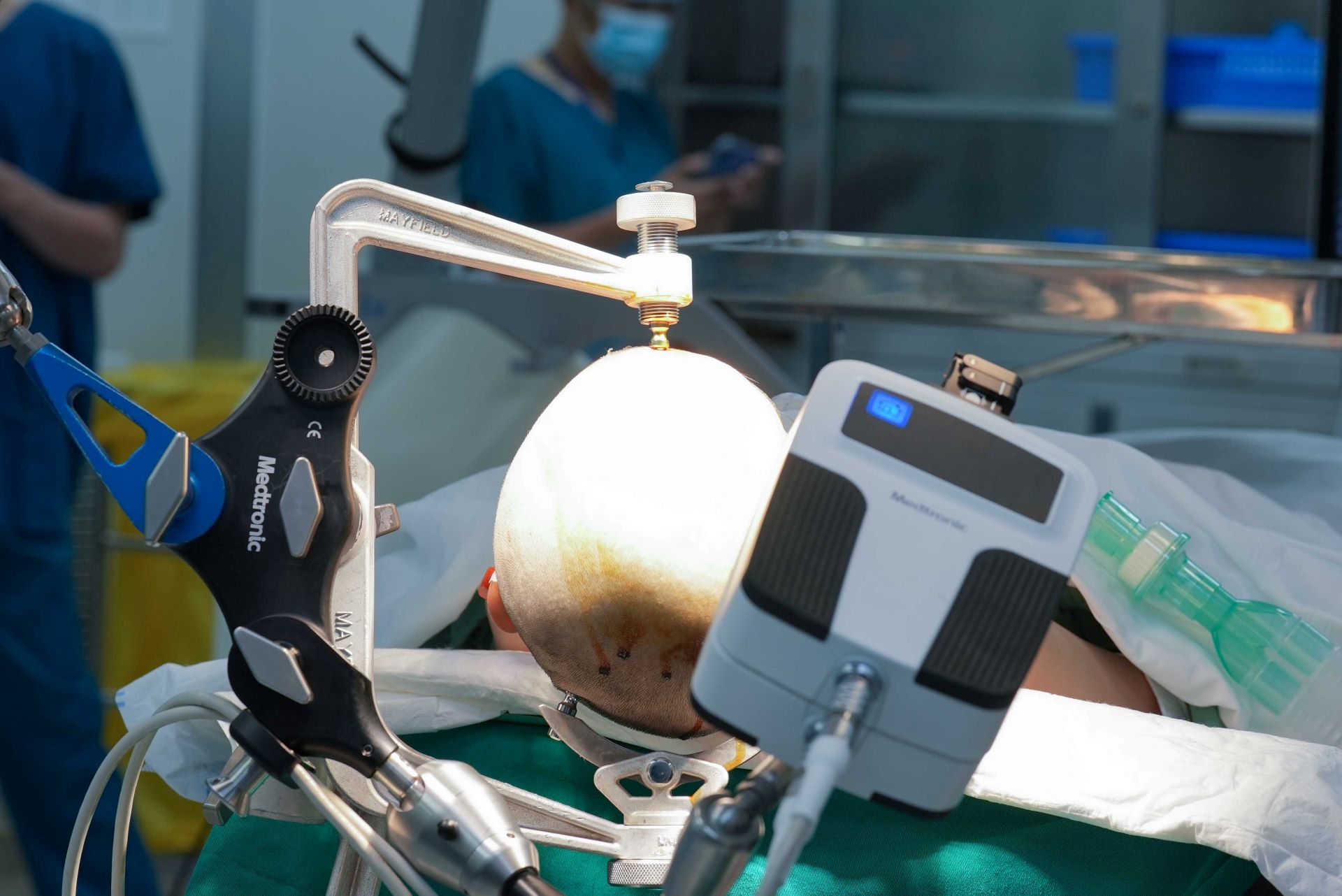 Robot AutoGuide lần đầu xuất hiện tại Việt Nam: Bước ngoặt công nghệ trong điều trị động kinh- Ảnh 1. Robot AutoGuide lần đầu xuất hiện tại Việt Nam: Bước ngoặt công nghệ trong điều trị động kinh- Ảnh 1.