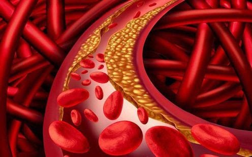 Tăng triglycerid máu: Hiểm họa tiềm ẩn và cách kiểm soát hiệu quả- Ảnh 1.