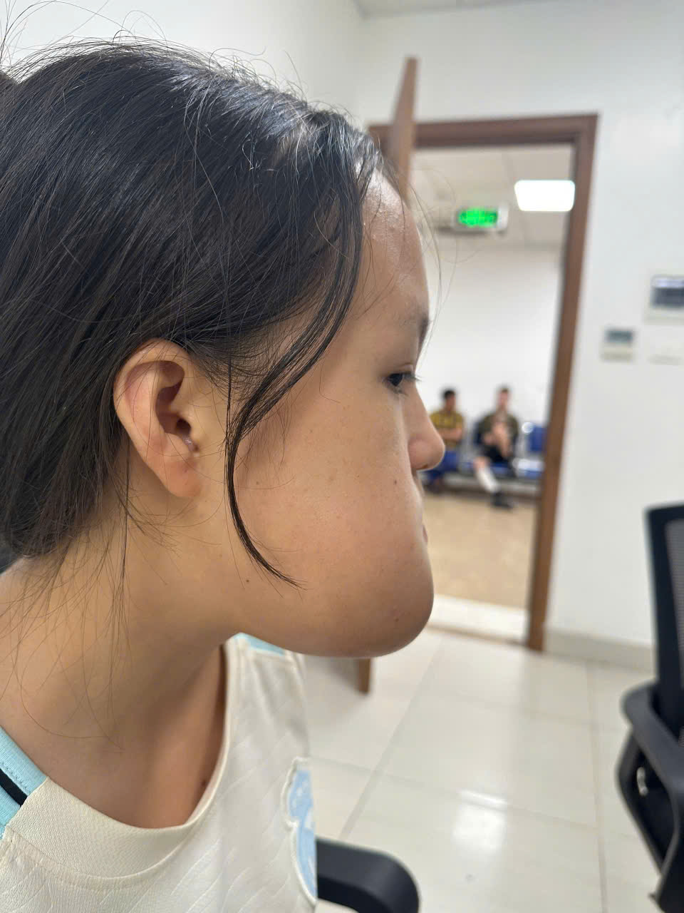 Phẫu thuật loại bỏ khối u, lấy lại thẩm mỹ khuôn mặt cho cô gái 16 tuổi- Ảnh 1. Phẫu thuật loại bỏ khối u, lấy lại thẩm mỹ khuôn mặt cho cô gái 16 tuổi- Ảnh 1.