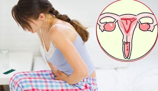 5 dấu hiệu nghi ngờ ung thư cổ tử cung chị em cần biết- Ảnh 1.