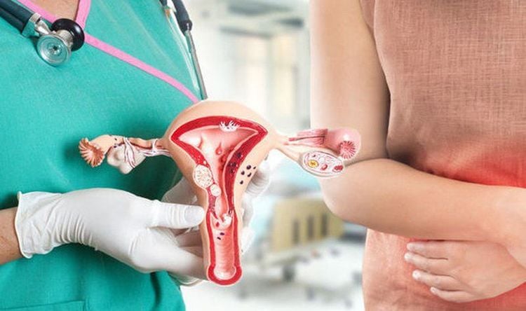 Polyp cổ tử cung có nguy hiểm không? Điều trị như thế nào? | Vinmec