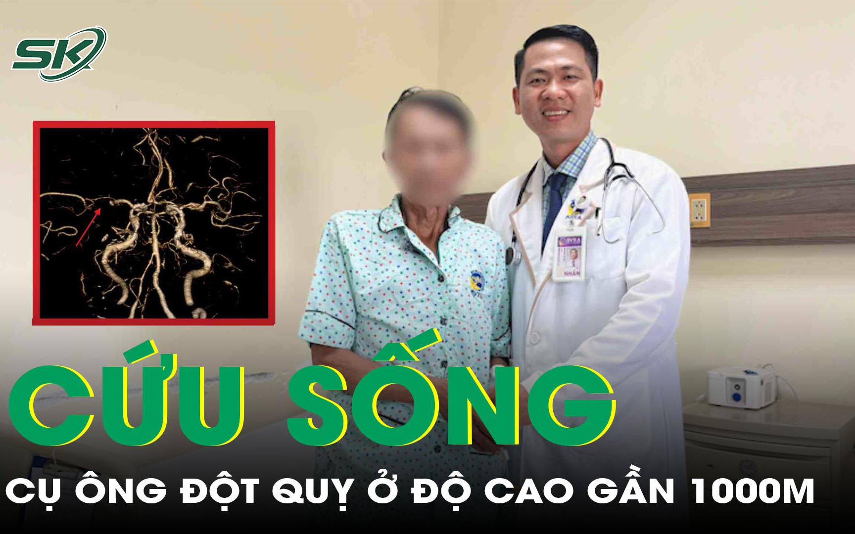 Cứu sống cụ ông 74 tuổi đột quỵ ở độ cao gần 1000 mét bằng can thiệp mạch não