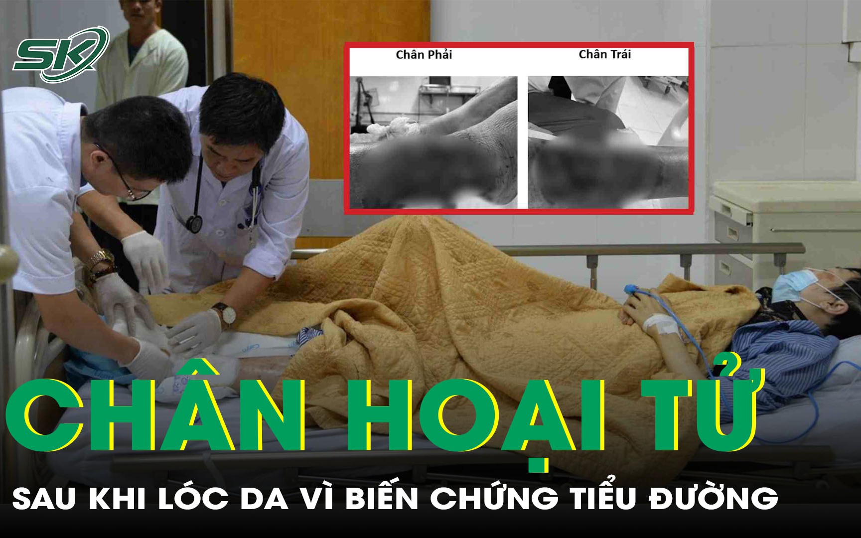Biến chứng thần kinh do đái tháo đường  - Ảnh 1.