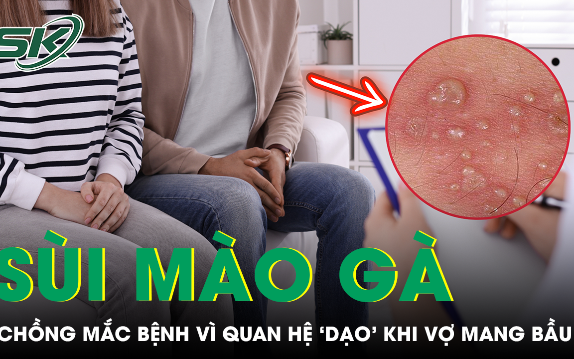 Nhiều trẻ vị thành niên mắc bệnh tình dục do quan hệ sớm- Ảnh 3. Quan hệ ngoài luồng khi vợ mang thai, người đàn ông choáng váng nhận kết quả mắc sùi mào gà