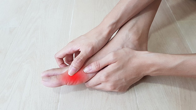 Cách giảm đau nhanh cơn gout cấp- Ảnh 1. nhung-dieu-can-lam-khi-trieu-chung-gout-tai-phat11652239700