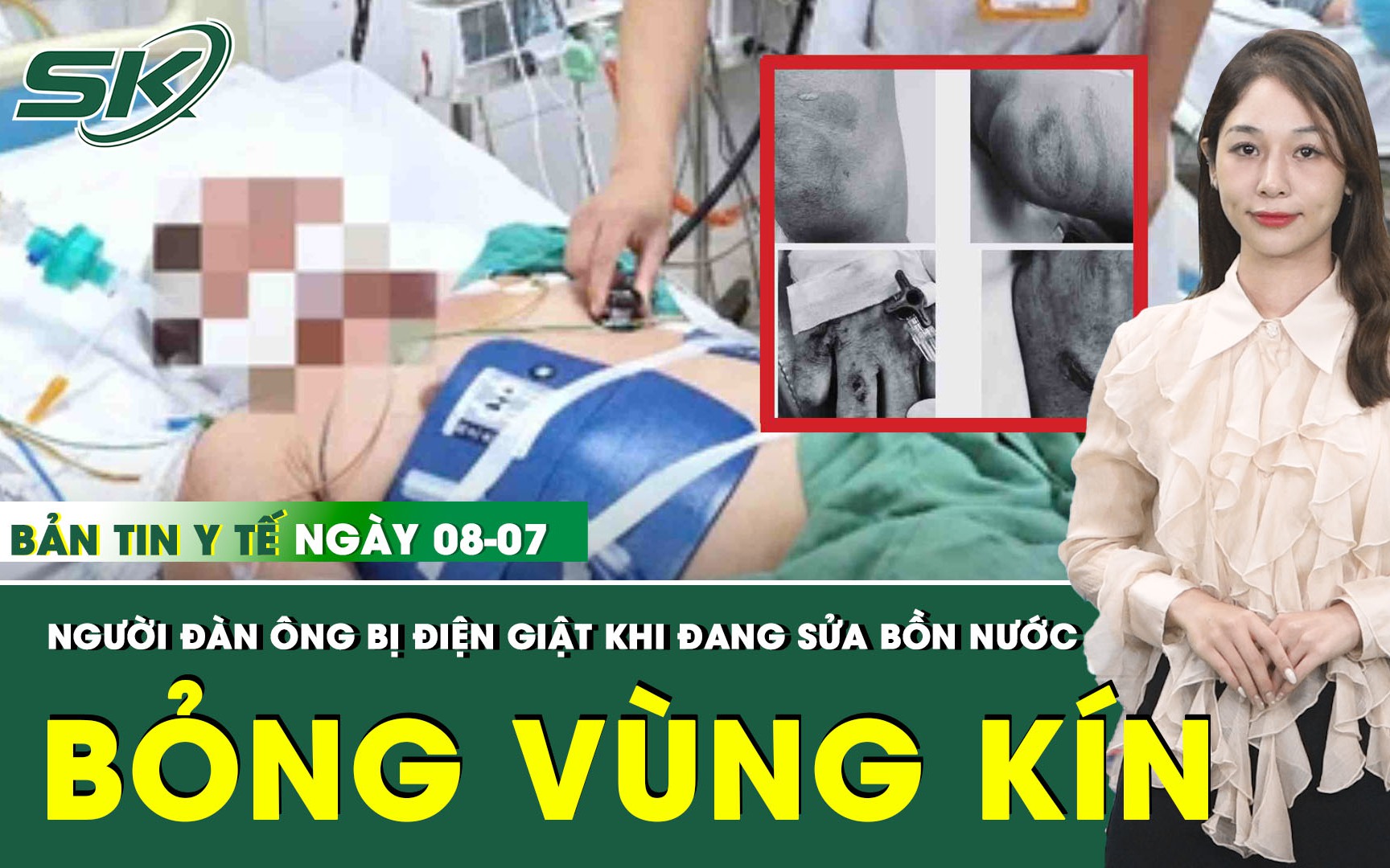 Bản tin Y tế 8/7: Sửa bồn nước trên tầng thượng, người đàn ông ngưng thở, vùng kín bỏng nặng