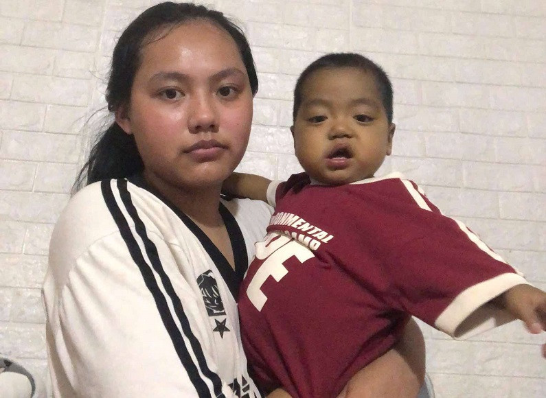 Sự sống mong manh của bé trai 21 tháng tuổi bị teo mật bẩm sinh, xơ gan- Ảnh 2. Sự sống mong manh của bé trai 21 tháng tuổi bị teo mật bẩm sinh, xơ gan- Ảnh 2.
