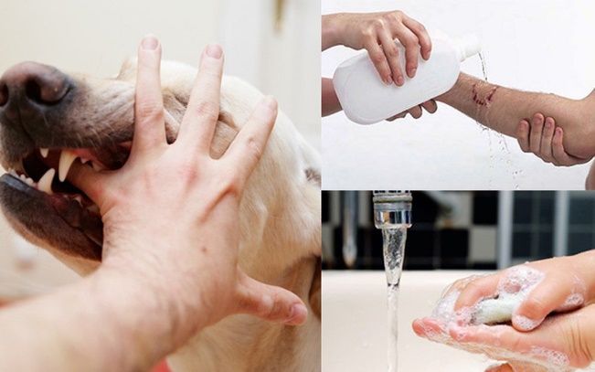 Dấu hiệu và triệu chứng của bệnh dại