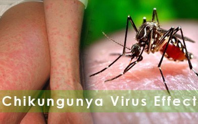 Bộ Y tế: Tăng cường giám sát dịch Chikungunya ngay tại cửa khẩu, cơ sở y tế, cộng đồng để phát hiện sớm ca bệnh