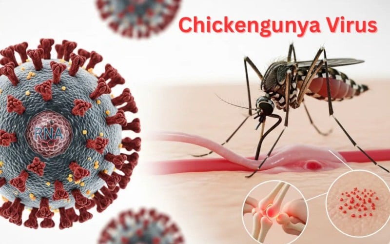 Muỗi đốt truyền bệnh Chikungunya lưu hành tại nhiều địa phương, Bộ Y tế nói gì về nguy cơ dịch bệnh này?
