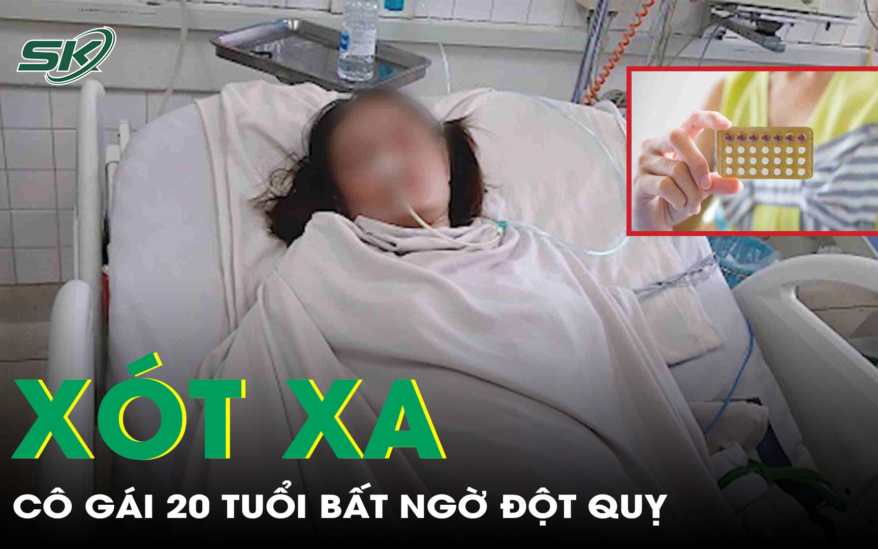 Cô gái 20 tuổi đột quỵ sau khi liên tục dùng thuốc tránh thai và mắc béo phì 