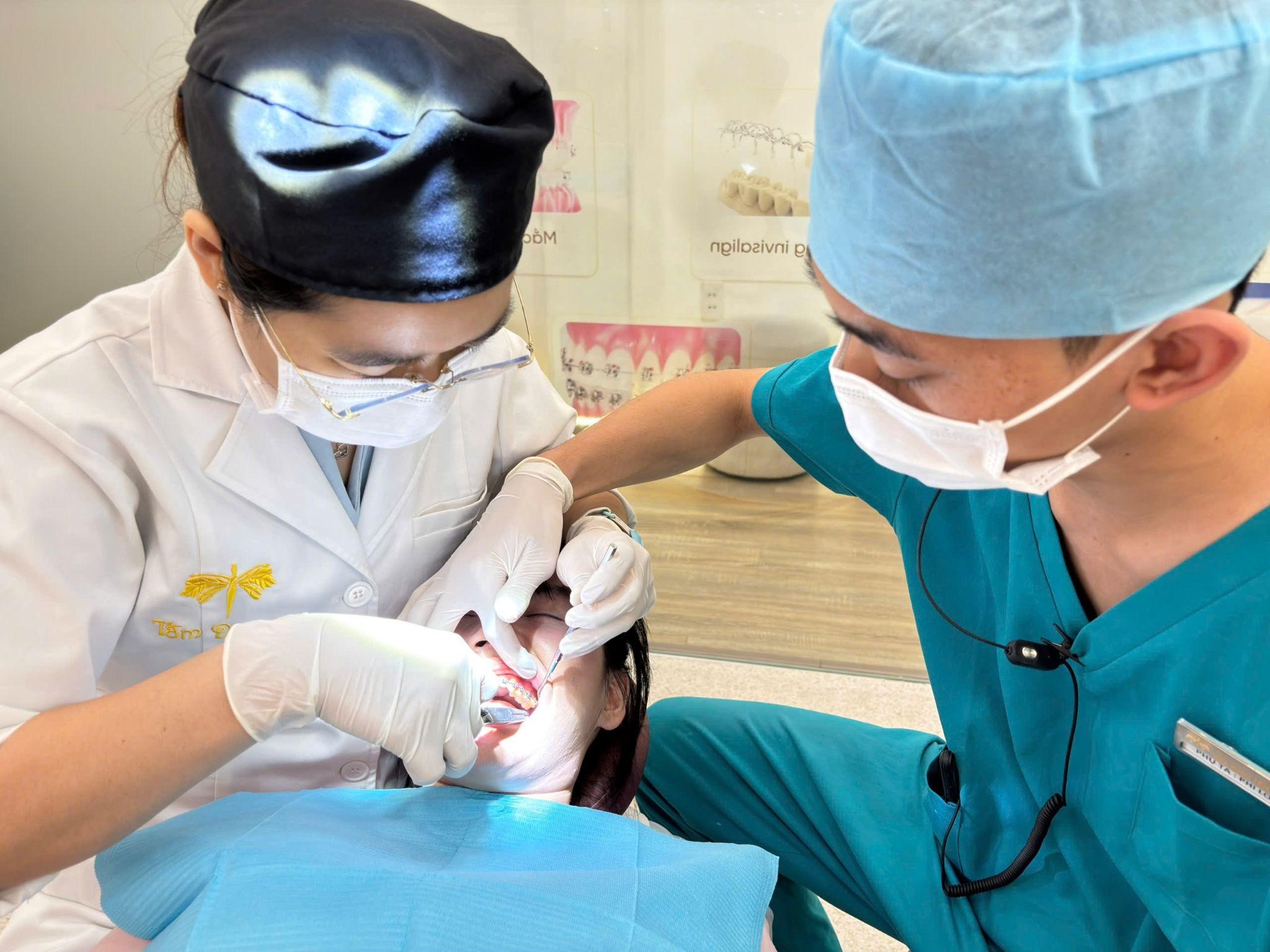 Loại mắc cài nào tốt nhất để niềng răng?- Ảnh 4.