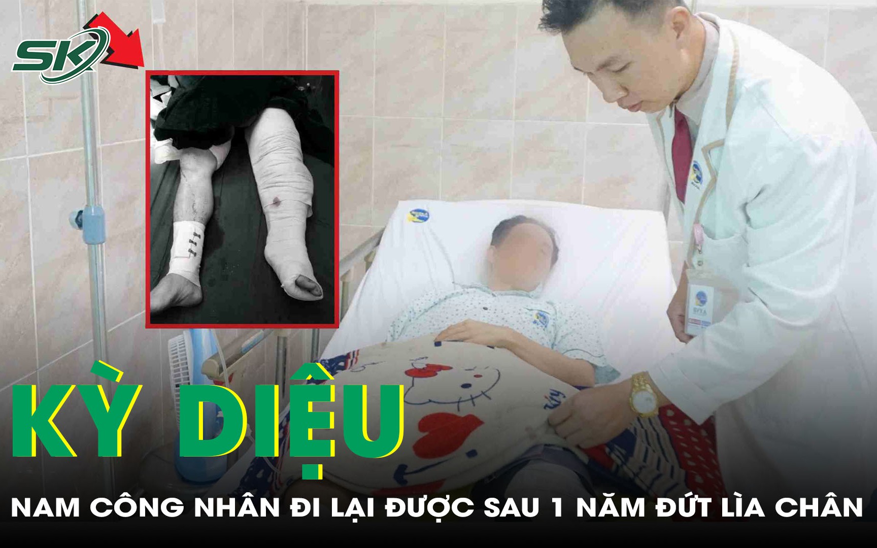 Liên tiếp nối thành công hai ca đứt lìa cổ chân- Ảnh 3.