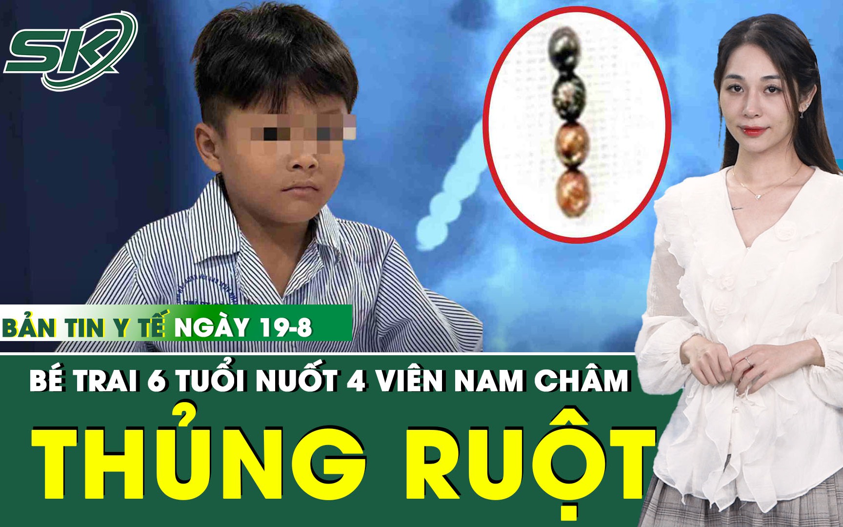 Bản tin Y tế 19/8: Nuốt 4 viên nam châm, bé trai 6 tuổi thủng ruột