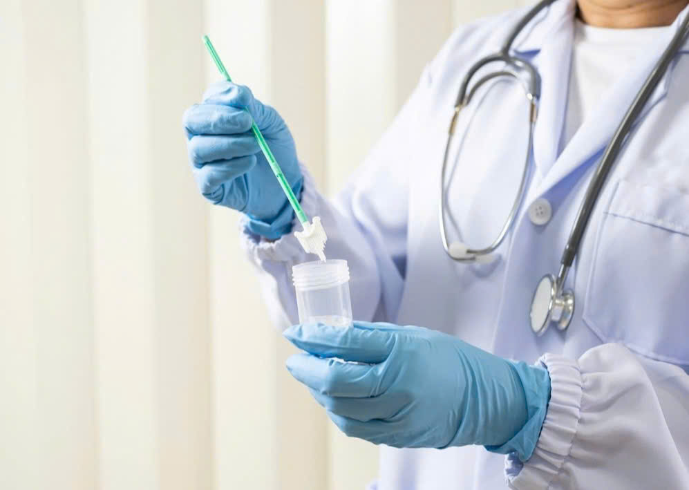 Những dấu hiệu cảnh báo ung thư cổ tử cung ở phụ nữ trẻ- Ảnh 1.