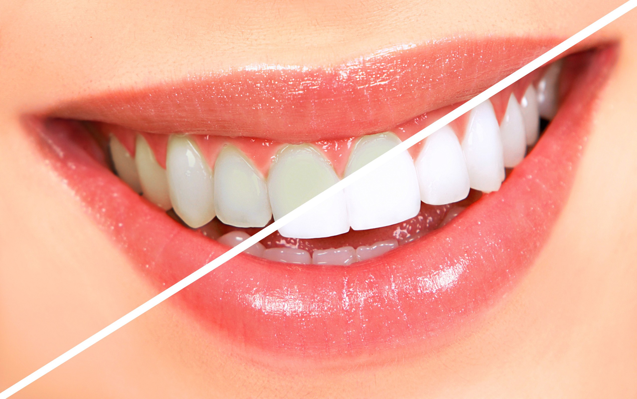 Thói quen xấu làm hại men răng thường gặp- Ảnh 2.