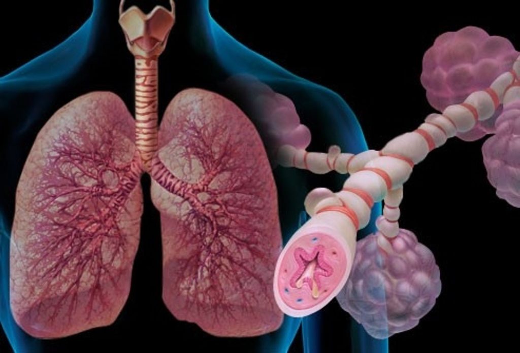 Hen phế quản và các biện pháp phòng ngừa – Trung tâm kiểm soát bệnh tật  Vĩnh Phúc