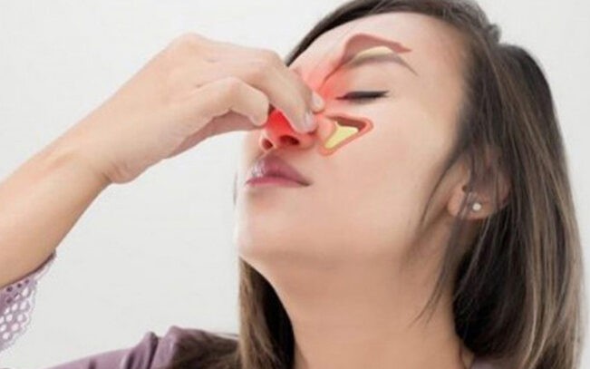 Viêm xoang mũi dị ứng chữa thế nào?