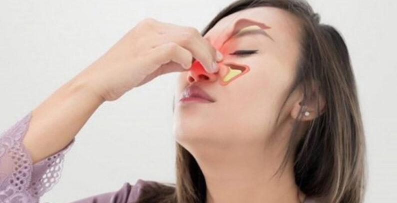 Viêm xoang mũi dị ứng chữa thế nào?- Ảnh 1. Viêm xoang dị ứng: Những lưu ý cần biết để điều trị kịp thời - Bệnh Viện Đa Khoa Quốc Tế Bắc Hà