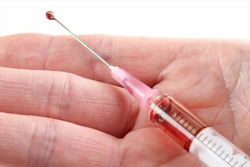 HIV có thể sống bao lâu ngoài cơ thể?- Ảnh 2.
