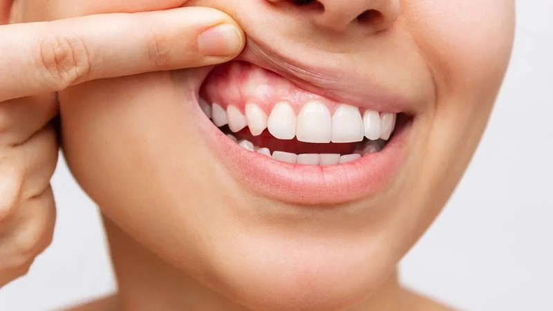 Nướu răng: 'người hùng' thường bị lãng quên- Ảnh 2.