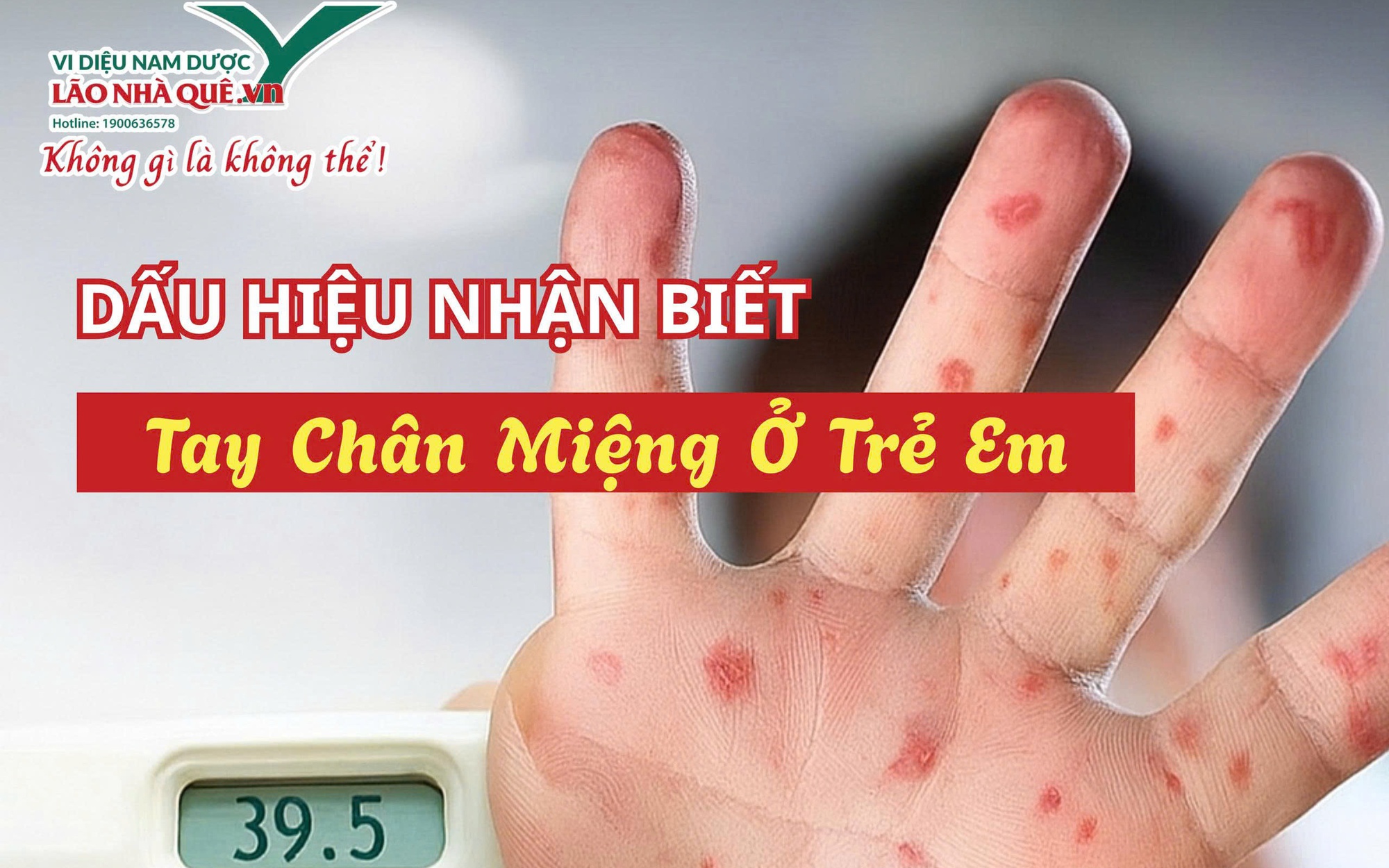 Bệnh tay chân miệng ở trẻ và cách hỗ trợ chăm sóc từ thảo dược tự nhiên